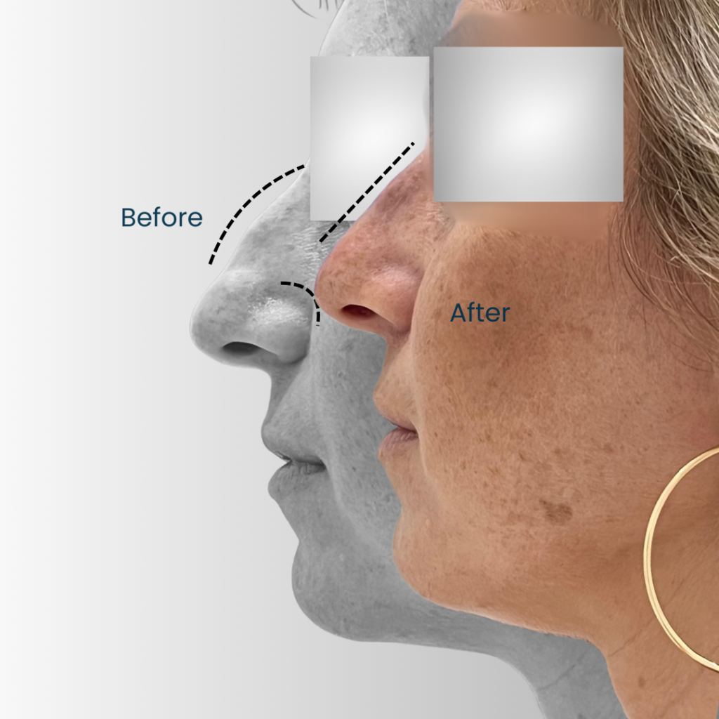 Landing page Before after 1