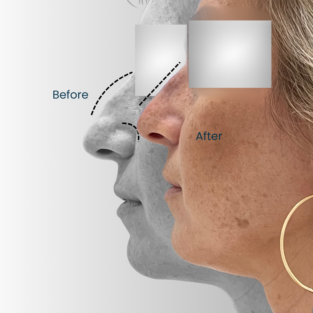 Landing page - Before after (1)