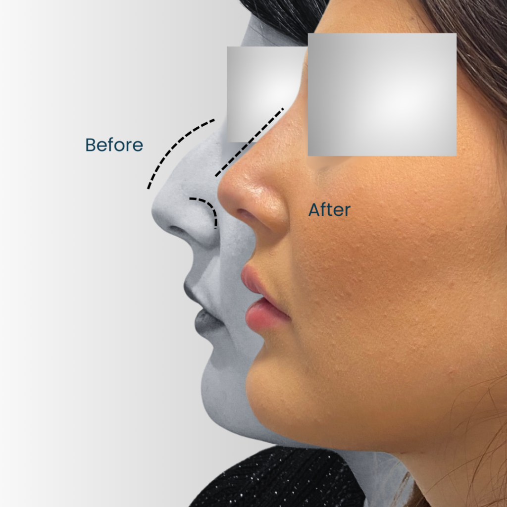 Landing page Before after