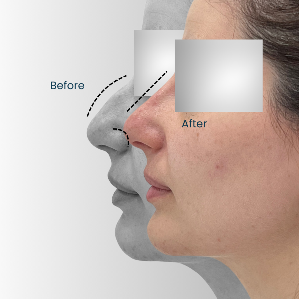 Landing page Before after 2