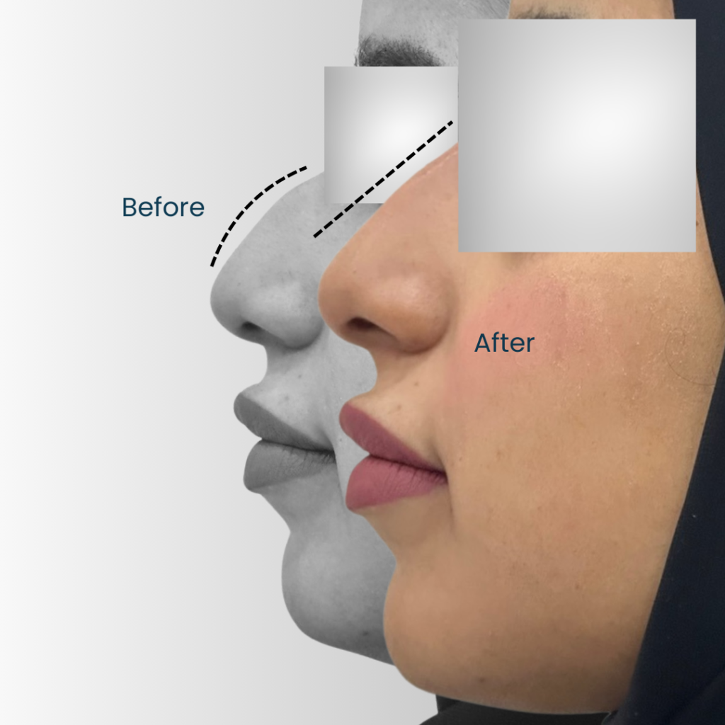 Landing page Before after 3