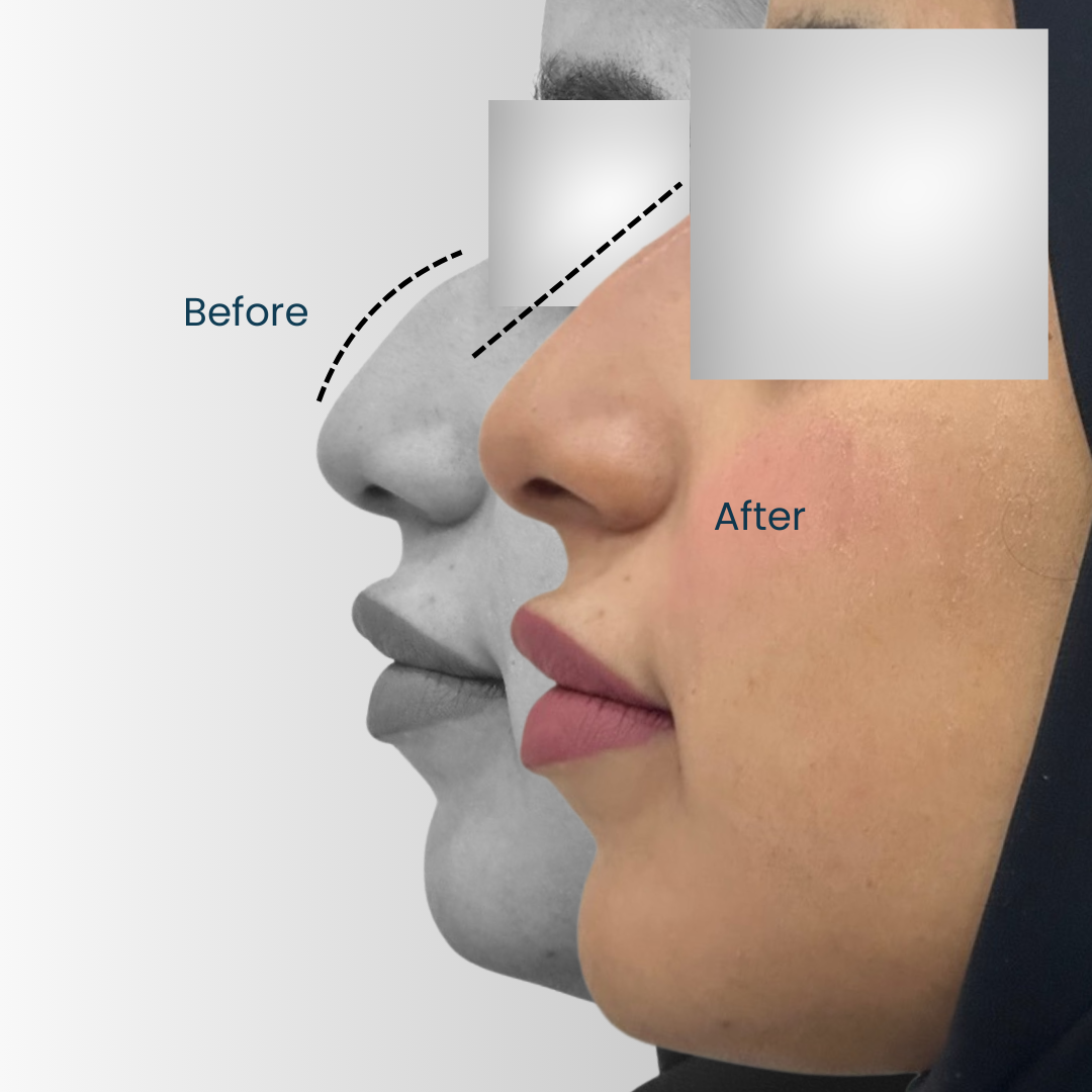 Landing page - Before after (3)