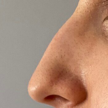 image.8817c9f0.nose 2b img 8029